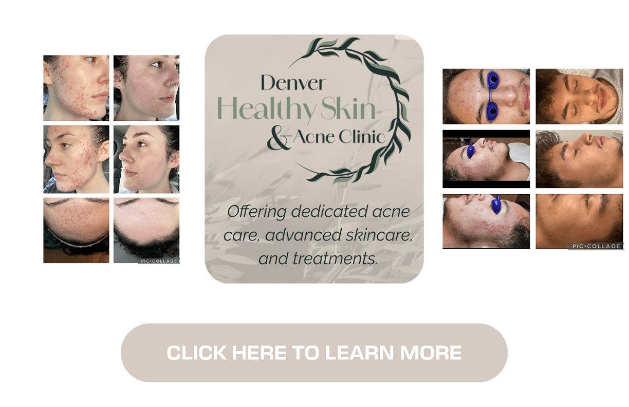 $$$/StateType/Normal